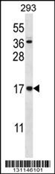CCDC58 Antibody (N-term)