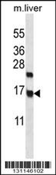 CCDC58 Antibody (N-term)