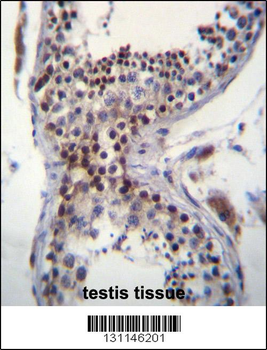 CCDC58 Antibody (N-term)
