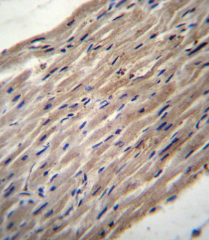 PLOD1 Antibody (N-term)