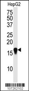 SUMO4 Antibody (M55 Wild type)