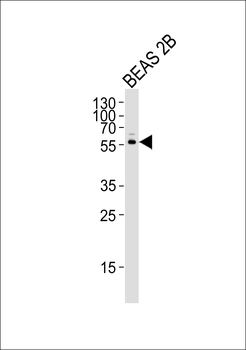 CYP2S1 Antibody (C-term)