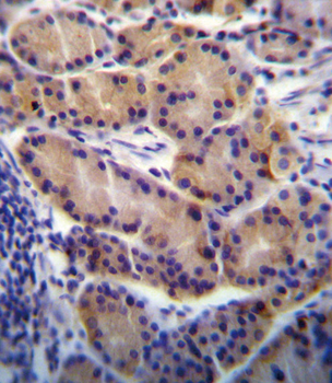 CYP2S1 Antibody (C-term)