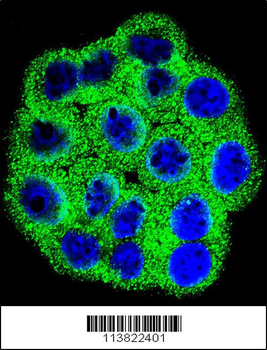 CDKN2B Antibody (C-term)