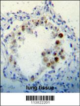 CDKN2B Antibody (C-term)