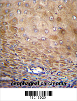TMEM43 Antibody (Center)
