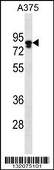 MLPH Antibody (C-term)