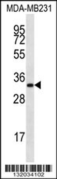 LIX1L Antibody (Center)