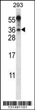 BEND6 Antibody (C-term)