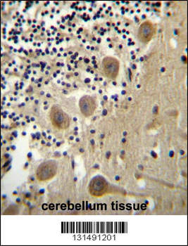 BEND6 Antibody (C-term)