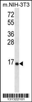 RPL23 Antibody (Center)