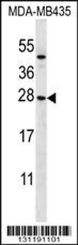 KLRC1 Antibody (N-term)