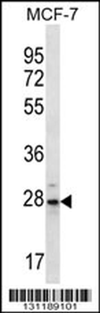 PSMB10 Antibody (C-term)