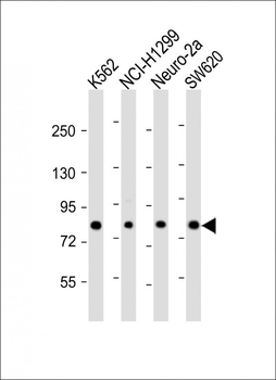 MLXIPL Antibody (C-term)