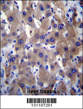 MLXIPL Antibody (C-term)