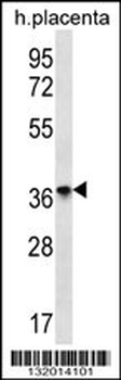 OR8D4 Antibody (C-term)