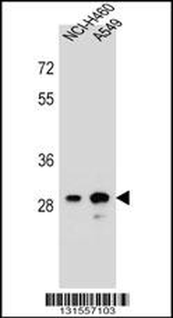DHRS4L1 Antibody (C-term)