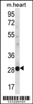 NCCRP1 Antibody (C-term)
