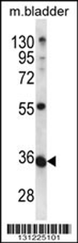 METTL11B Antibody (N-term)