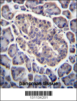 GPD2 Antibody (C-term)