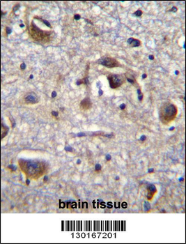 MAPK14 Antibody (Center T180/Y182)