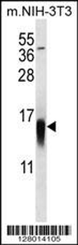 APG8b(MAP1LC3B) Antibody (N-term T29)