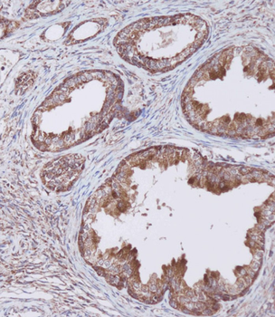 WFDC1 Antibody (C-term H163)