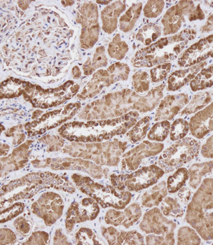 WFDC1 Antibody (C-term H163)
