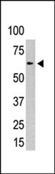 PIAS2 (PIASx1/2) Antibody (N-term)