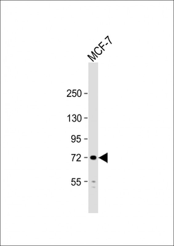 PIAS2 (PIASx1/2) Antibody (N-term)