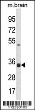 STX2 Antibody (Center)