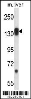 RPS6KC1 Antibody (N-term)