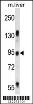 RASAL1 Antibody (Center)