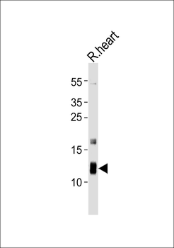 ATP5J Antibody (Center)