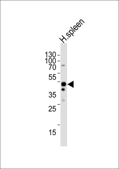 CHMP6 Antibody (N-term)