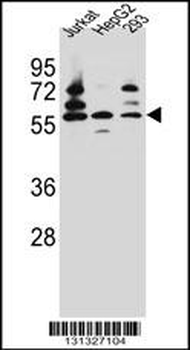 PDP1 Antibody (Center)