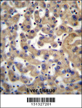 PDP1 Antibody (Center)