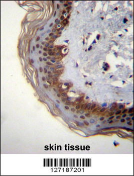RBM42 Antibody (C-term)