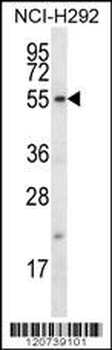 FBXO15 Antibody (N-term)