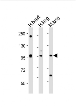 VSGP/F-spondin Antibody (N-term)