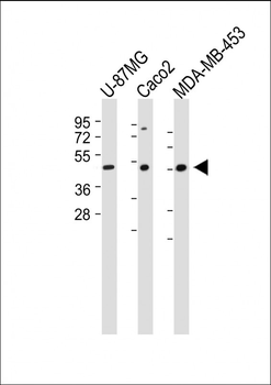 KCNJ13 Antibody (N-term)