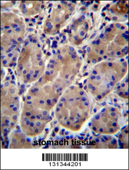 KCNJ13 Antibody (N-term)