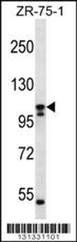 SLC12A6 Antibody (N-term)