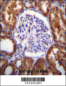 SLC12A6 Antibody (N-term)