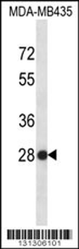 SNRPB2 Antibody (N-term)