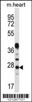 CRYBA1 Antibody (Center)