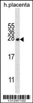 CRYBA1 Antibody (Center)