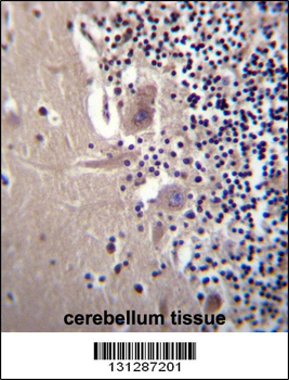 CRYBA1 Antibody (Center)