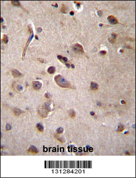 TSN Antibody (Center)