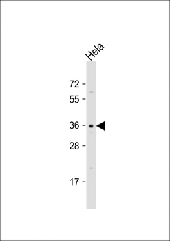 OR52E2 Antibody (C-term)